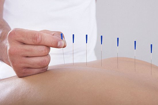 the-benefits-of-acupuncture-for-pain-relief_1.jpg